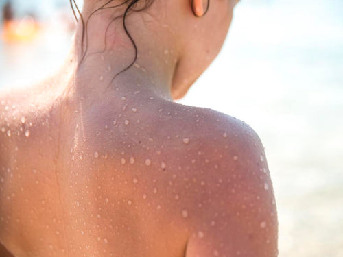 foto de una piel mojada bajo el sol. ¿por qué la piel de los niños es más sensible al sol? - Mustela España - 1