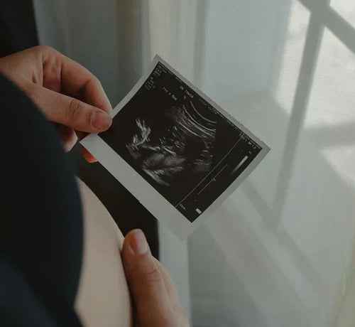 Ecografía de un bebé en el tercer mes de embarazo - Mustela España - 1