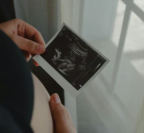 Ecografía de un bebé en el tercer mes de embarazo - Mustela España - 1