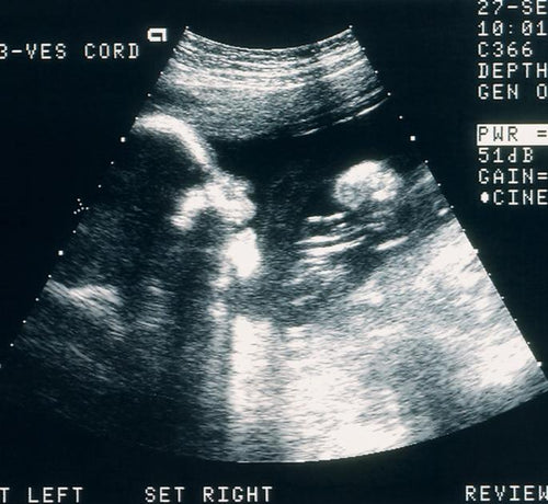 Consejos para un embarazo sin tabaco - Mustela España - 1